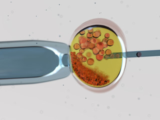 in vitro fertilization
