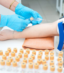 blood drawing from vein