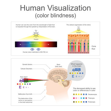 Human can see the color from wavelength of light. The destruction of the retina or perception in the brain abnormal. Illustration human body.