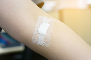 Gauze on an arm after a blood donation.