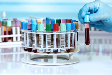 hand of doctor holding blood tube test and rack of blood samples in the laboratory / Technician...