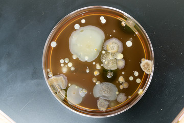 A petri dish with colonies of microorganisms for bacteriological analysis in a microbiological laboratory