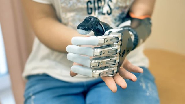 Female using futuristic robotic cyborg arm. Real modern medical robotic prosthesis.