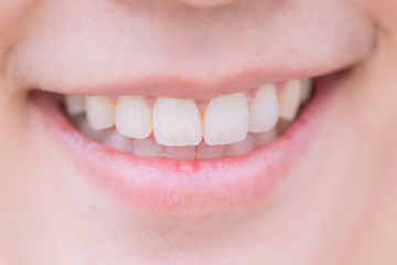 closeup mouth good dental smile with white healthy teeth
