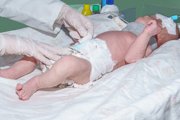 Nurse changing diaper of newborn baby in neonatal intensive care unit at children's hospital