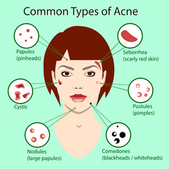 Different type of acne. Vector Illustration with skin problems. woman face isolated