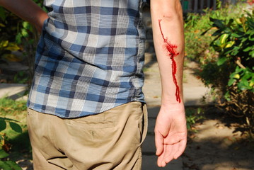 Blessure sanglante du bras
