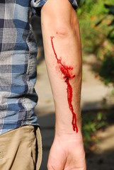 Blessure sanglante du bras