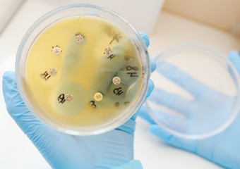 Petri dishes in the bacteriological laboratory closeup
