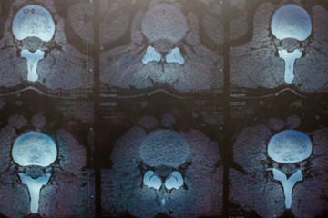 Magnetic resonance imaging.