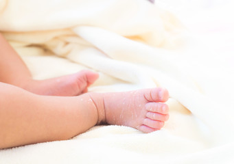 Fototapeta na wymiar Closeup legs of newborn with peeling skin on white cloth, health care and medical concept, selective focus