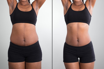 Before And After Concept Showing Fat To Slim Woman - obrazy, fototapety, plakaty