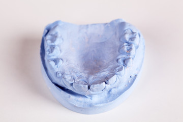 Fototapeta premium Gebissabdruck