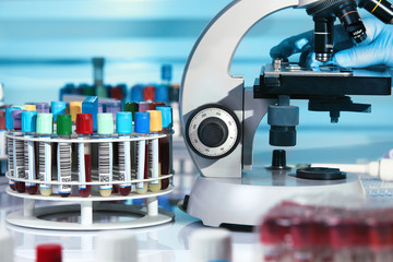 technician examining sample of blood in the microscope in the laboratory / doctor in the lab...
