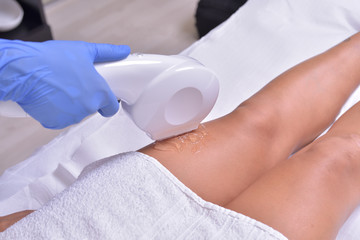 Hair removal with a diode laser with a wavelength of 808 nm. Epilation of the leg and buttocks with...