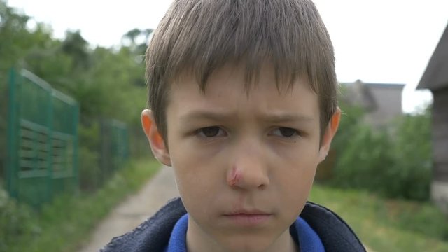 Angry Beaten Pained Boy on the Street closeup, Plans on Revenge
