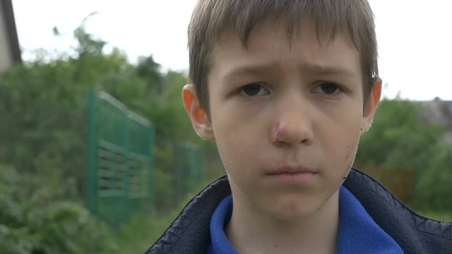 Angry Beaten Pained Boy on the Street closeup, Plans on Revenge