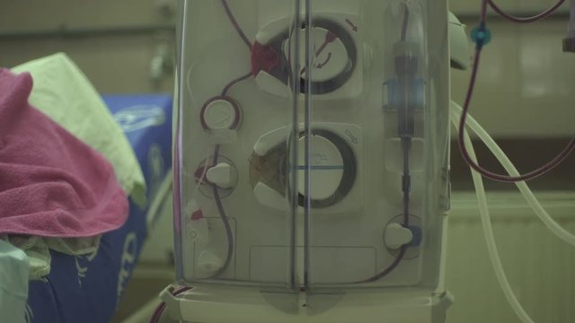 Hemodialysis machine determinates and pumps blood, tracking shot on the hand of woman that lying on the bed during peritoneal dialysis treatment, close up, shallow depth of field, real scene