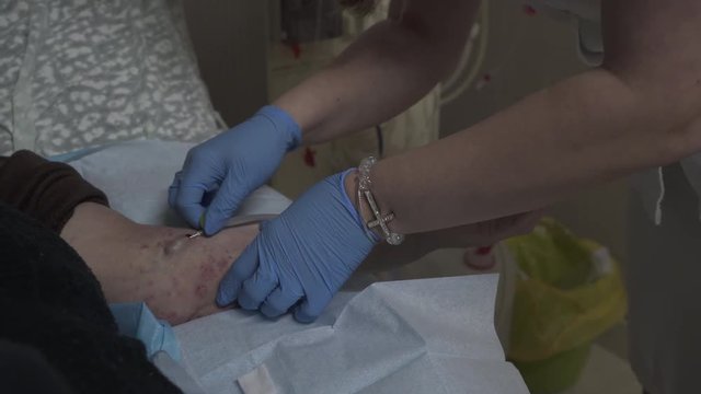 Caucasian female technician injects hemodialysis patient in stabbed hand during treatment close up, tilt up to face close up of charming middle aged nurse, concept medical equipment, indoors