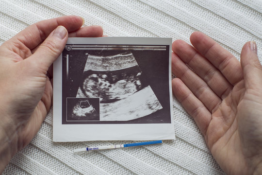 Women's hands holding ultrasonography photo of her baby