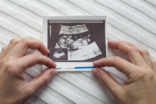 Ultrasound photo of baby with woman hands background