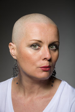 beautiful woman cancer patient without hair