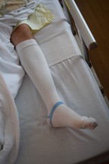 Medical elastic stockings,  prevention of postoperative complications,  medical pressure socks