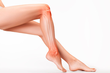 Female legs with pain zone illustrated.
