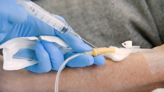 Plasmapheresis - the process of excretion of blood plasma from the circulation