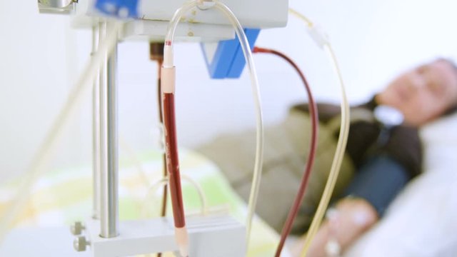 plasmapheresis - the removal of plasma from the blood. Plasma in a special medical bag