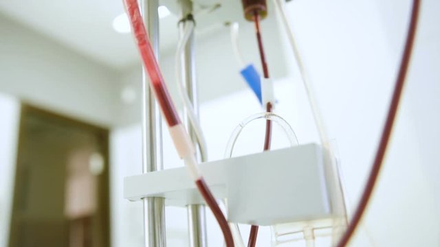 plasmapheresis - the removal of plasma from the blood. Plasma in a special medical bag