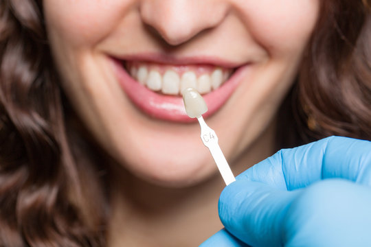 Detaltechniker hält Zahnfarbprobe vor weiblichen Mund