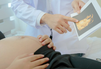 Pregnant woman is lying in bed while doctor showing the ultrasound image.
