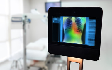 ..Artificial intelligence in smart healthcare hospital technology concept. Robot assistant , adviser use AI algorithm and machine learning detect Pneumonia and cancer cell in digital filmless X-Rays p