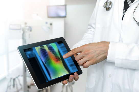 Artificial intelligence in smart healthcare hospital technology concept. Professional doctor use AI algorithm and machine learning detect Pneumonia and cancer cell in digital filmless X-Rays process.