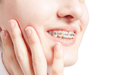 Beautiful young woman with teeth braces