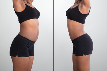 Before And After Concept Showing Fat To Slim Woman