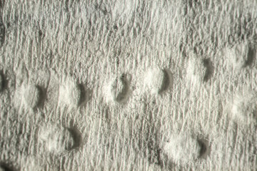 texture. enlarged with a slit lamp paper tissue for hands