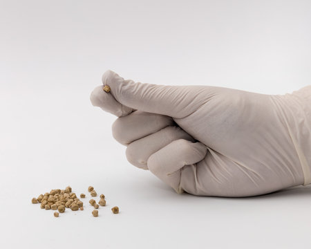 Arzt h&auml;lt entnommene Gallensteine eines Patienten in der Hand und betrachtet diese