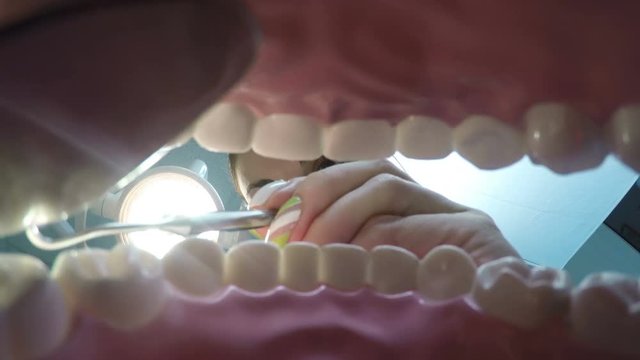 View from the mouth at the dentist