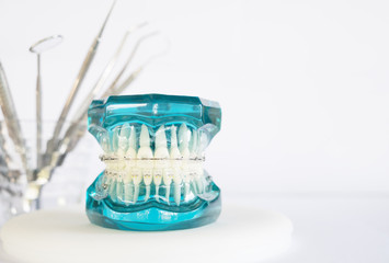 orthodontic model and dentist tool - demonstration teeth model of varities of orthodontic bracket...