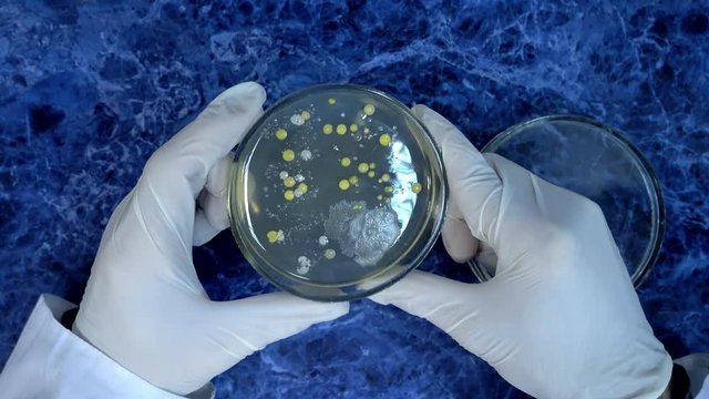 Glitter of bacteria colonies. Mold on a petri dish. Examination of bacterial colonies on a petri dish. Colonies of staphylococcus and mold. Inspection of bacterial colonies in a circle.