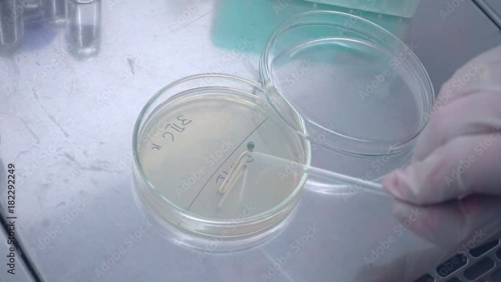 Poster experiment in the laboratory. sample selection. microbiological laboratory work. plant a strain of b