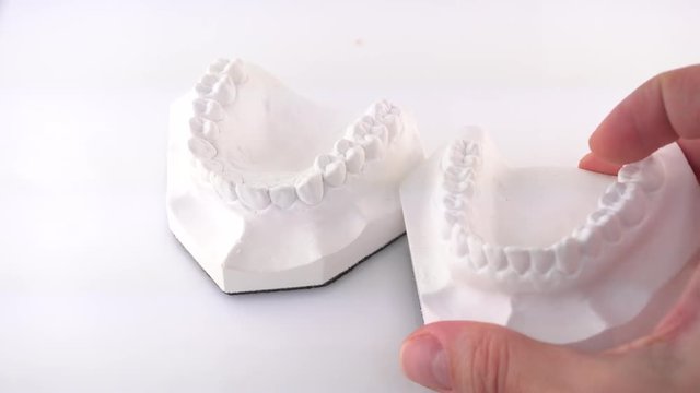 Hand of female doctor holding orthodontic dentures of ceramics