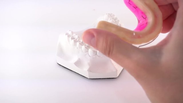 Hand of female doctor holding orthodontic dentures of ceramics