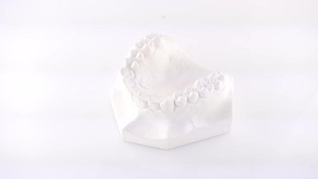 Hand of female doctor holding orthodontic dentures of ceramics