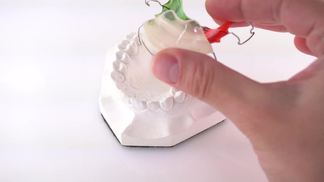 Hand of female doctor holding orthodontic dentures of ceramics