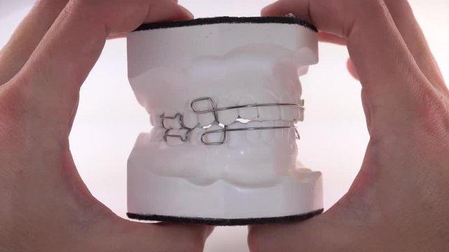 Hand of female doctor holding orthodontic dentures of ceramics 