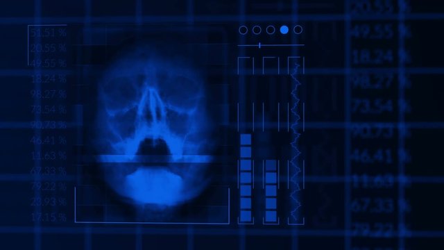 Scan of a human skull, looped blue hud interface medical equipment