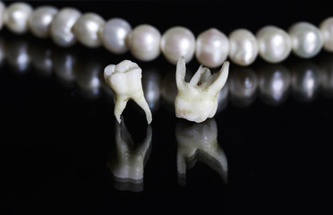 two bad rotten tooth pulled out and lie opposite the dazzling white pearls on a black isolated...